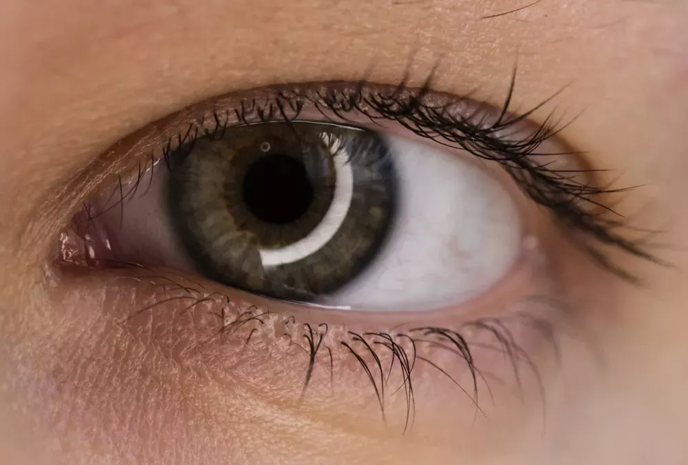 Fokus Auge – Teil 3