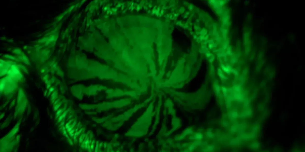 Trockene Augen Syndrom